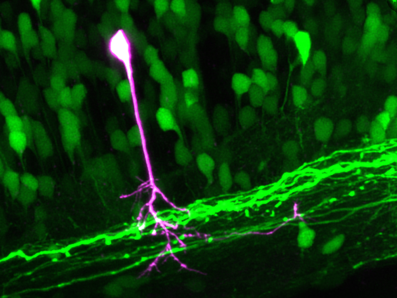 Vergr?sserte Ansicht: Motorische Nervenzellen im Rückenmark einer lebenden Zebrafisch-Larve
