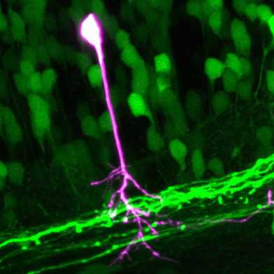 Motorische Nervenzellen im Rückenmark einer lebenden Zebrafisch-Larve
