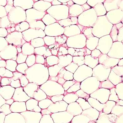 Mikroskopieaufnahmen von grossen Fettzellen