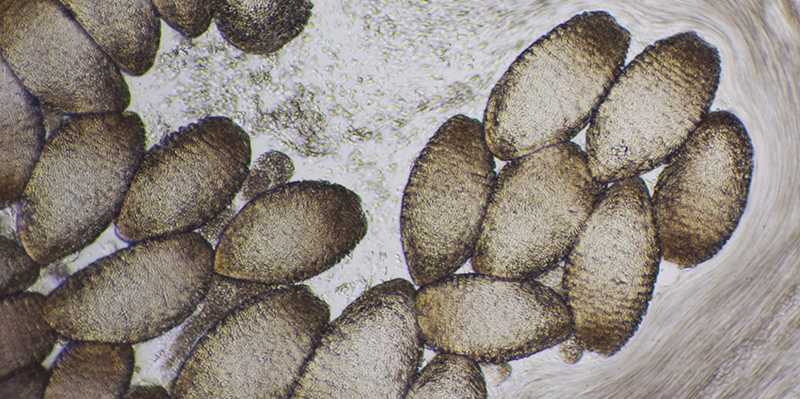 Vergr?sserte Ansicht: Das Sekret des Schleimaals unter dem Mikroskop: In den kokonartigen Zellen ist der Proteinfaden auf spezielle Weise aufgewickelt. (Bild: ETH Zürich/Simon Kuster)