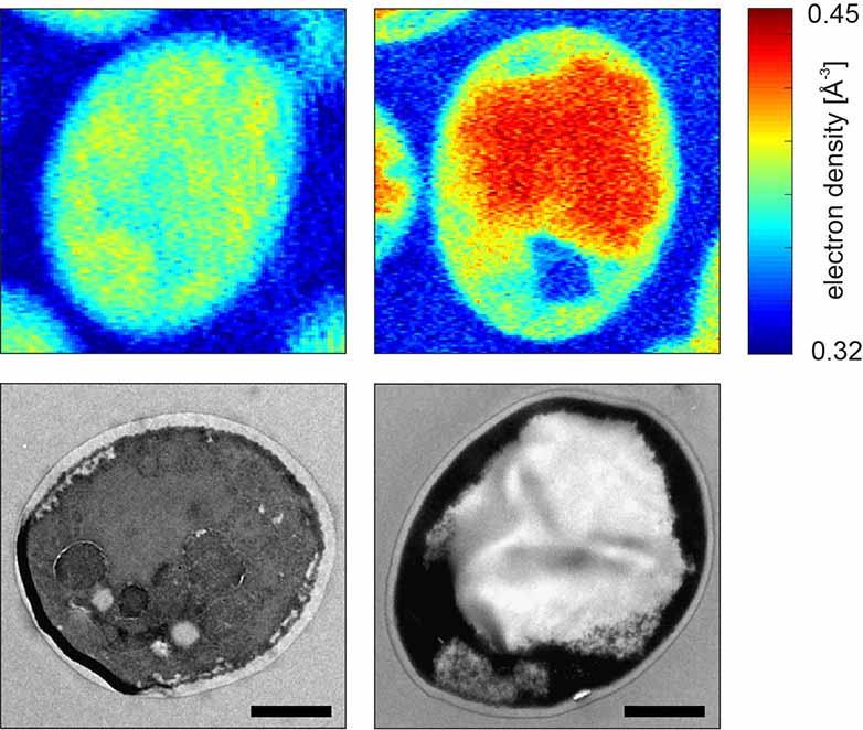 Stärkeproduzierende Hefezellen dargestellt durch ptychographische Kryo-Röntgentomographie (oben) und Elektronenmikroskopie (unten). Die Zellen links sind unverändert und bilden keine Stärke. Der Balken entspricht 1 µm. 