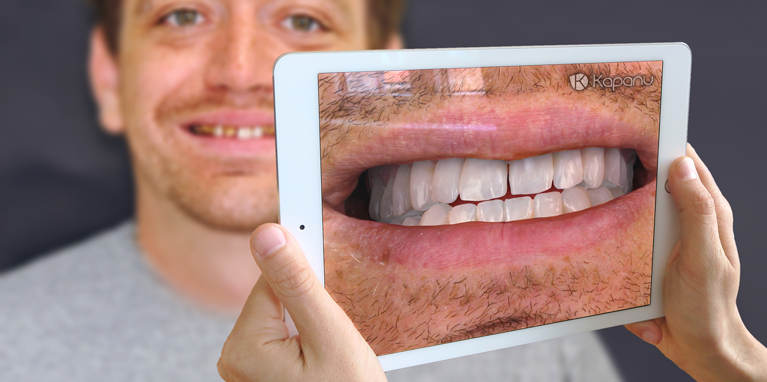 Vergr?sserte Ansicht: Danke der Kapanu-Software können Patienten und Zahnärzte vor dem Eingriff das angestrebte Ergebnis von Zahnkorrekturen sehen. (Bild: Kapanu)