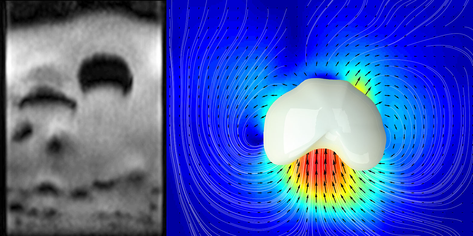 Vergr?sserte Ansicht: ETH-Forscher haben aufsteigende Blasen in gasdurchströmten granularen Medien mit Magnetresonanztomographie sichtbar gemacht (links). Auch die Geschwindigkeiten der einzelnen Partikel (Pfeile im rechten Bild) können so gemessen werden. (Bild: Alexander Penn / ETH Zürich)