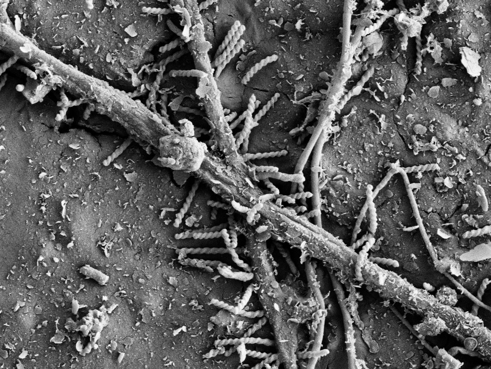 Vergr?sserte Ansicht: Bakterien gesellen sich für den Bioabbau zu den Pilzfäden. (Elektronenmikroskopie-Bilder: ETH Zürich / Gruppe Umweltchemie)