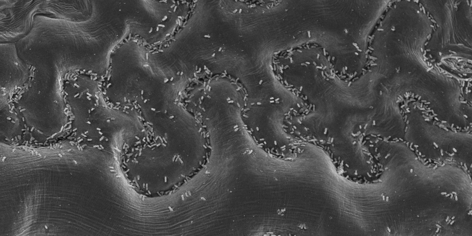 Vergr?sserte Ansicht: Auf Blattoberflächen lebt eine reichhaltige Mikrobengemeinschaft, die zahlreiche noch unerforschte Naturstoffe produziert. (Bild: Gerd Innerebner / Roger Wepf, ScopeM)