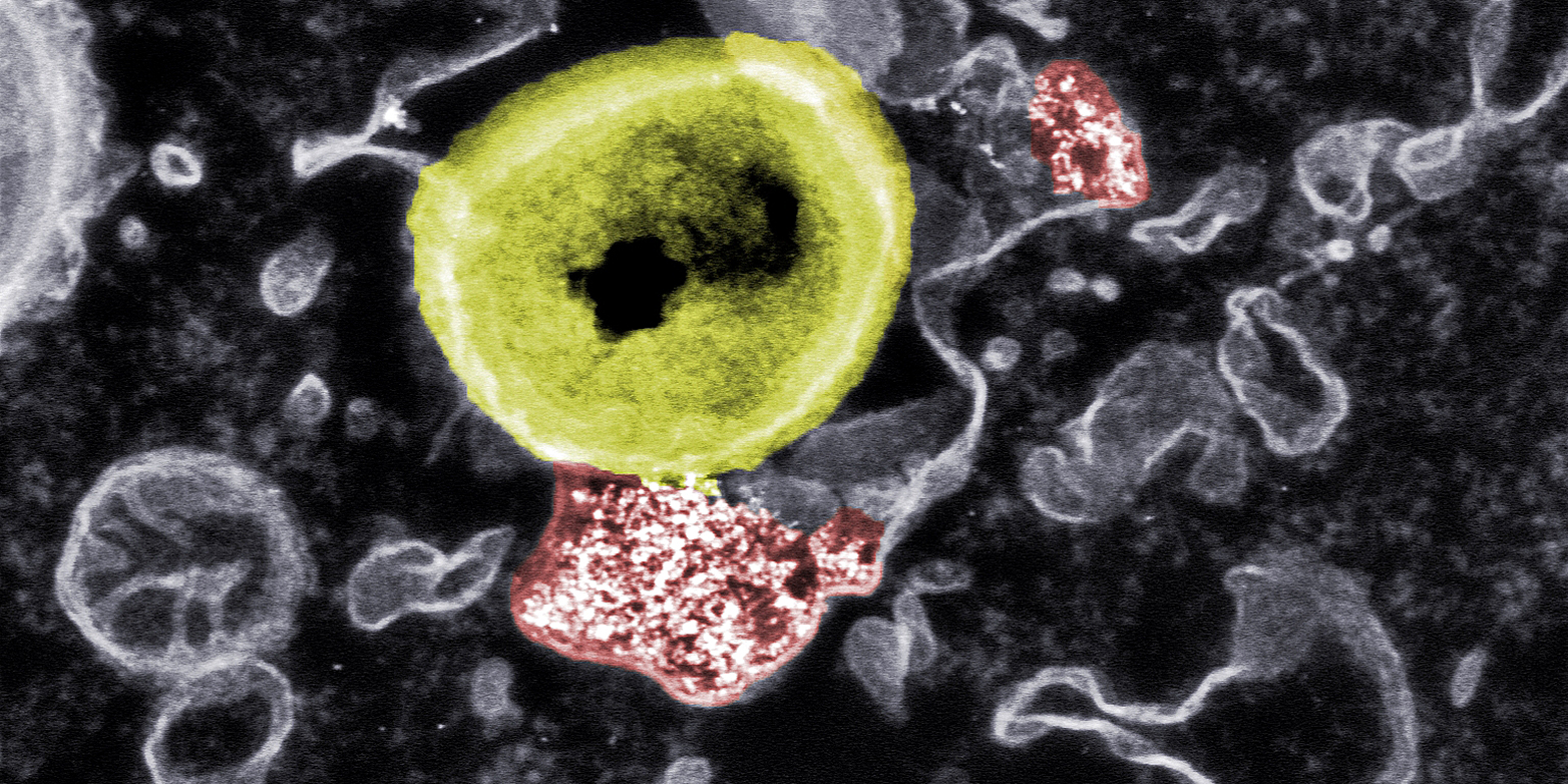 Nanopartikel und resistentes Bakterium