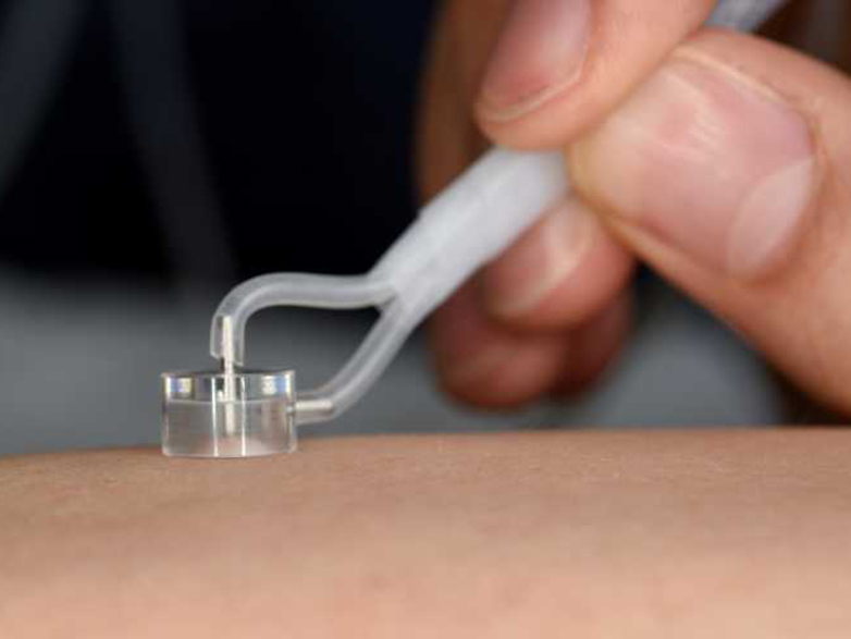 Mit Vakuum zieht «Nimble» an der Haut. Der Messkopf ist nur 10 Millimeter breit. (Bild: ETH Zürich / Bettina Müller)
