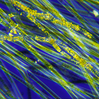 Cyanobakterien unter dem Mikroskop