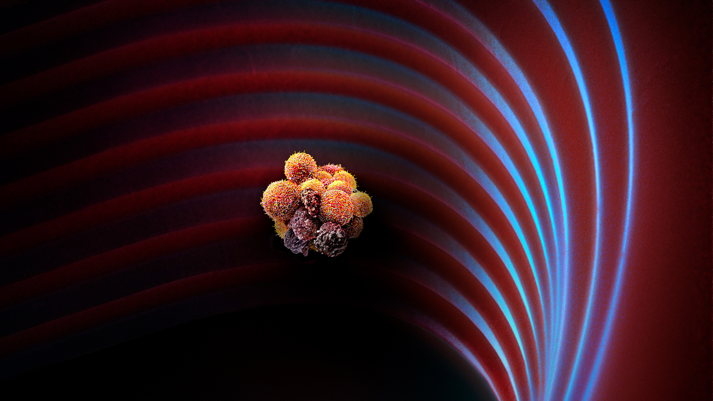 Eine klumpenartige Ansammlung von Krebszellen unter dem Elektronenmikroskop