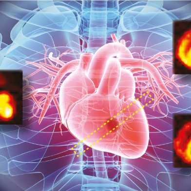 Illustration eines Brustkorbes indem das menschliche Herz sichtbar ist
