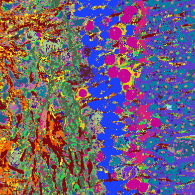 Querschnitt Netzhaut-Orgnoid: Unterschiedliche Proteine durch unterschiedlichen Farben erkennbar