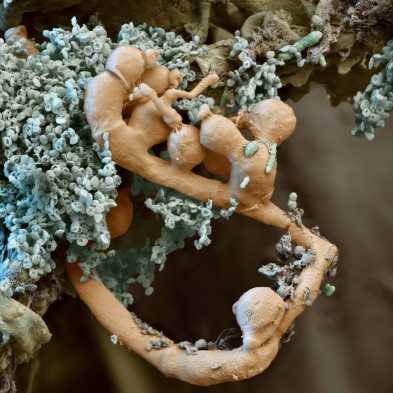 Mikroskopische Aufnahme von Mikroben auf Humus