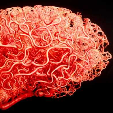Gehirn simuliert aus Blutgefässen