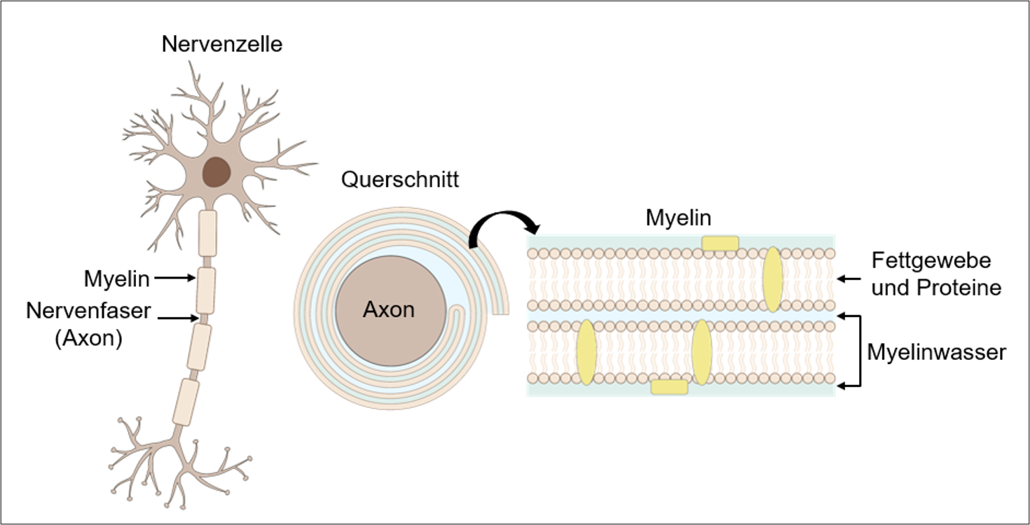 Vergr?sserte Ansicht: Querschnitt der Nervenzelle, bestehend aus Axon und Myelin. Das Myelin besteht aus zwei Schichten Fettgewebe und Proteinen mit dazwischen jeweils Myelinwasser.