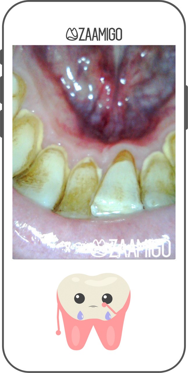 image of inside of mouth as shown on a mobile phone