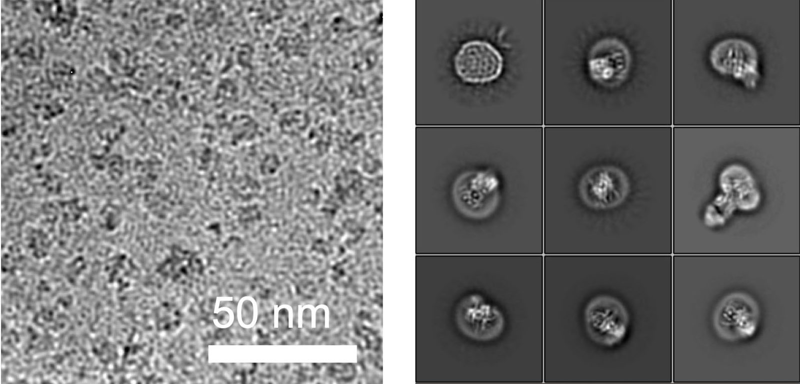 Left: Representative cryo-EM image of ALG6-Fab particles. Right: 2D classes of thousands of averaged ALG6 Fab particles. (Photograph: Joël S. Bloch / ETH Zurich)
